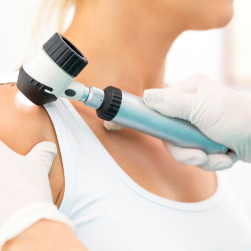Dermatoscopia