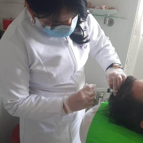 Mesoterapia Capilar