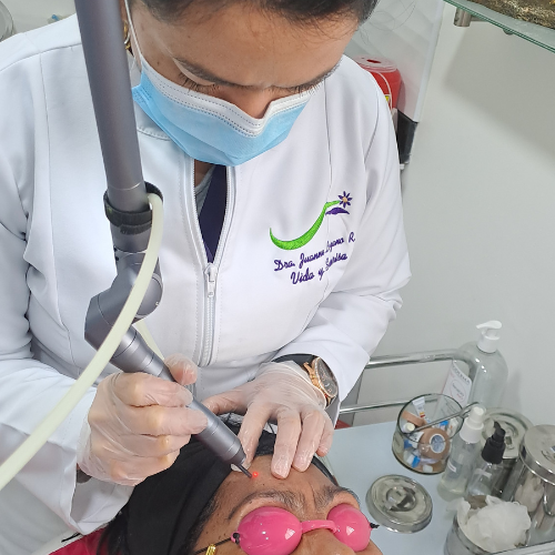 Remoción con Laser CO2
