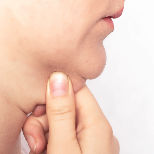 Papada y cuello